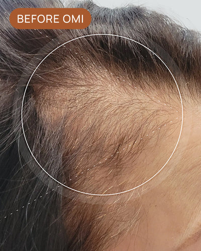 Debra L's hairline before using OMI