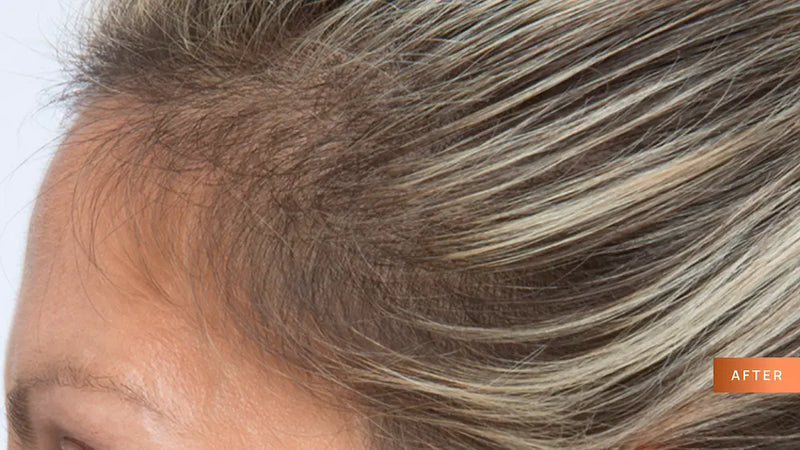 Close-up of hair with gray and blonde coloration, labeled 'AFTER' on a light background.