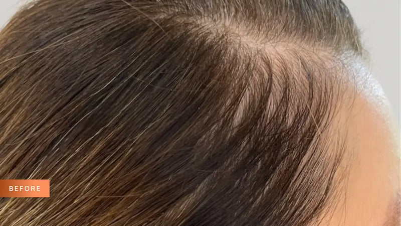 Close-up of a person's head with styled hair, labeled 'before' on a gray background