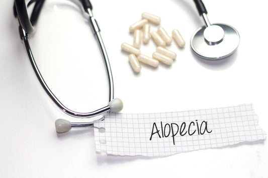 Alopecia Areata