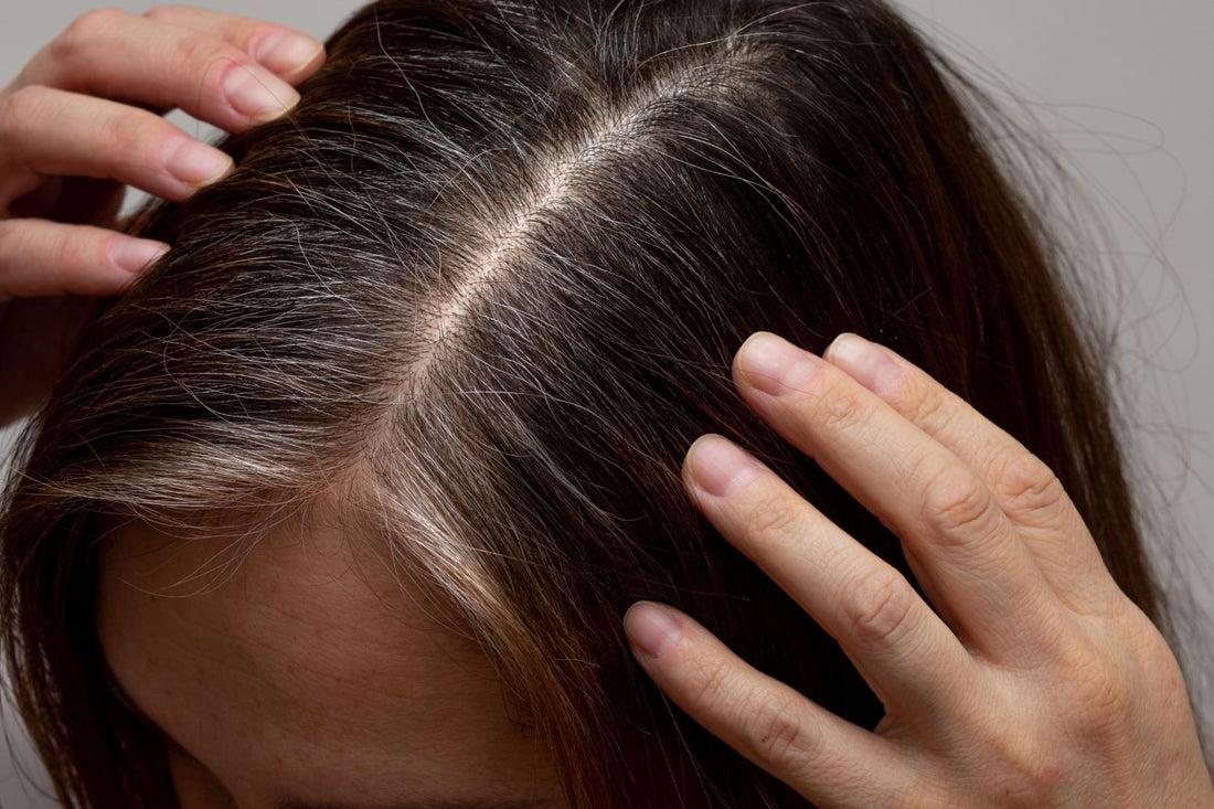 Hair Regrowth vs. Hair Transplants: Better Alternatives To Consider