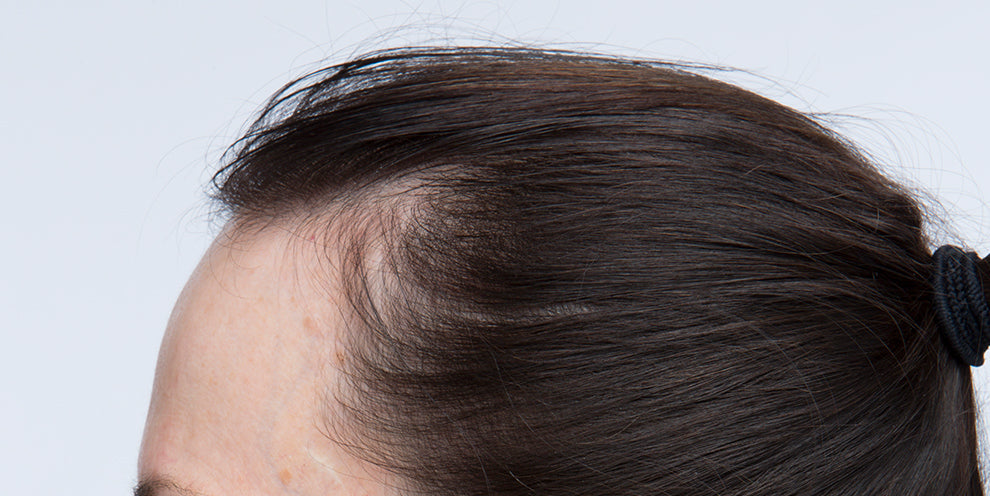 Pro Tips:  Taking Before & After Photos