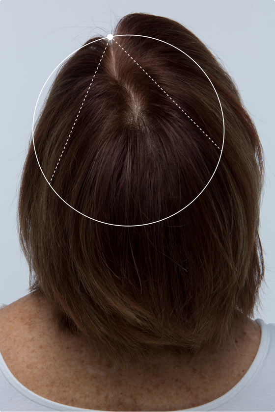 3 MONTHS SCALP COVERAGE