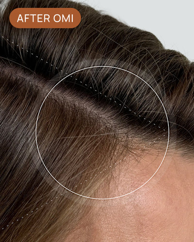 Caroline L's hairline after using OMI