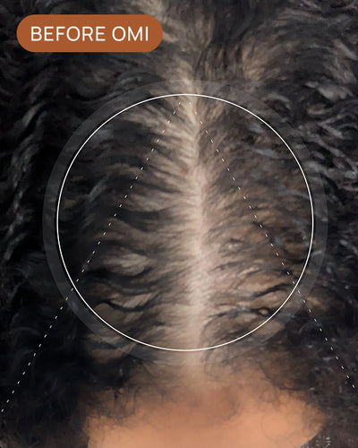 Cara P's hairline before using OMI