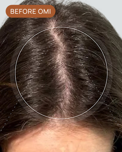 Customer Ondrea's hair density before using OMI Nourish