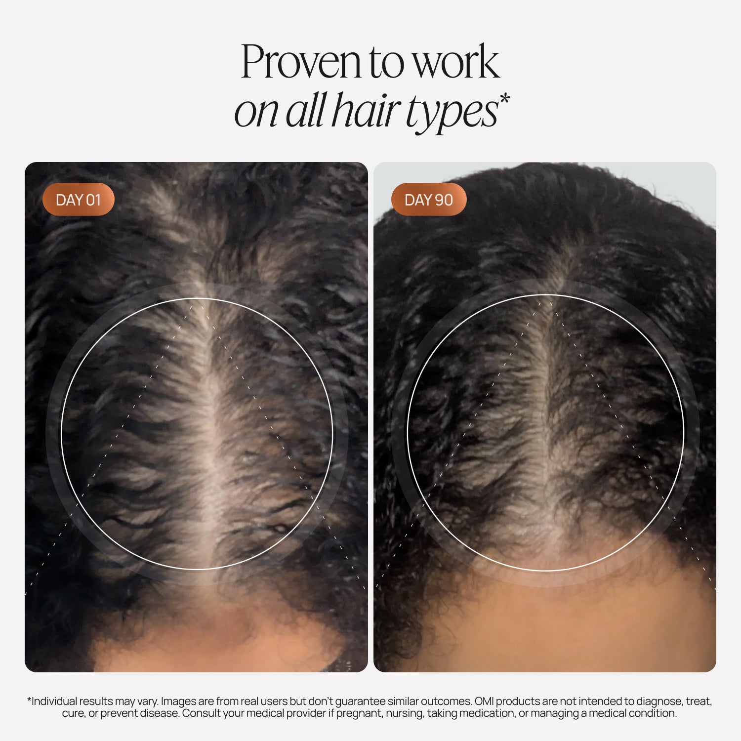 Hair Growth Peptides for Women - NOURISH – OMI Wellbeauty