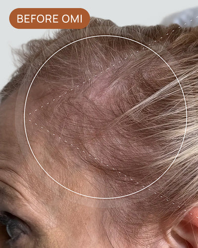 Deb D's hairline before using OMI