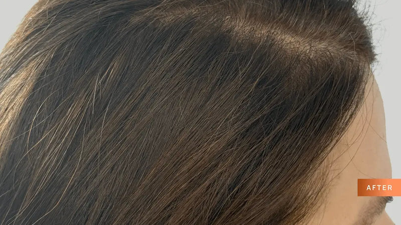 Close-up of a person's head with styled hair, labeled 'AFTER' on a gray background