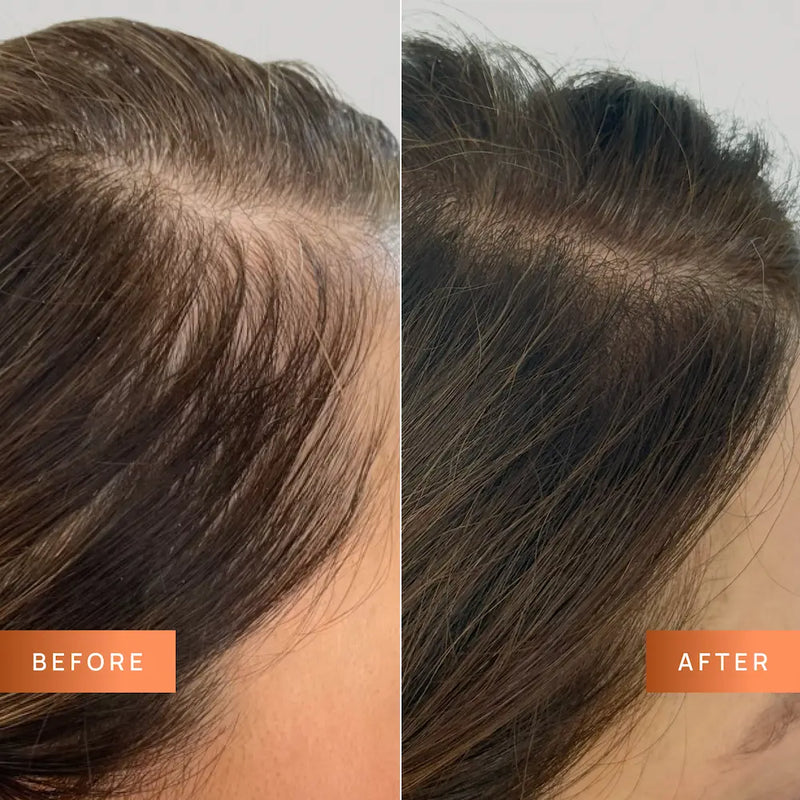 Before and after comparison of hair treatment on a person's head.