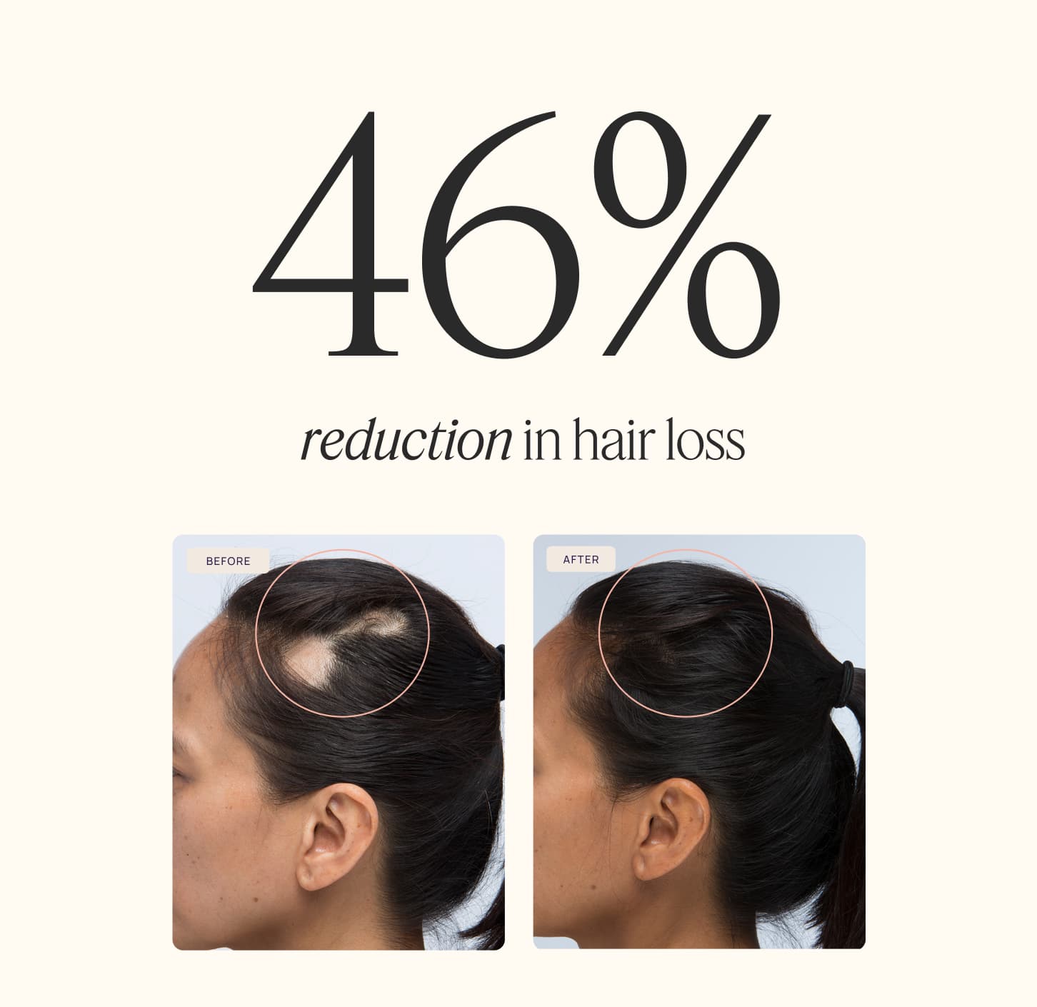 46% percent reduction in hair loss - Hair Growth Peptides Gummies